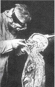 Photographie en noir et blanc d'un homme introduisant un bronchoscope dans la trachée d'un cadavre.