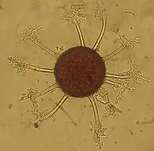 Une sphère brune entourée de sortes d'appendices transparents