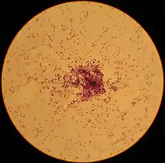 Description de l'image Lactococcus_lactis.jpg.