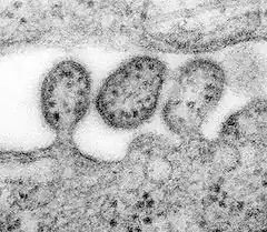 Virus de Lassa en fin de détachement de l'enveloppe virale.