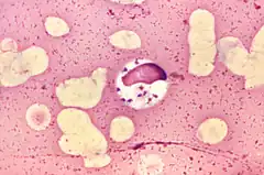 Leishmania donovani (Euglenozoa, Trypanosomatidae)