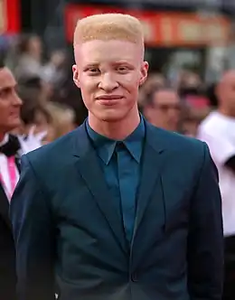Shaun Ross dans les rôles de l'Albinos n°2 et n°3