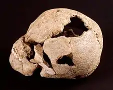 Un crâne trépané vers 4600 av. J.-C.