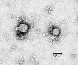 Description de l'image Lymphocytic choriomeningitis virus.jpg.