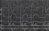 Sphygmographie intracardiaque: courbes de pression pulsée obtenue avec une cartographie des phases chronologiques de la contraction cardiaque, 1873.