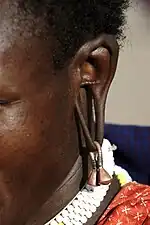 Oreille d'une femme africaine déformée par le port de lourdes boucles d'oreille