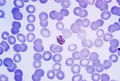 Description de l'image Mature Plasmodium malariae schizont PHIL 2715 lores.jpg.