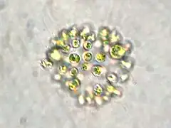 Microcystis aeruginosa (Microcystaceae).