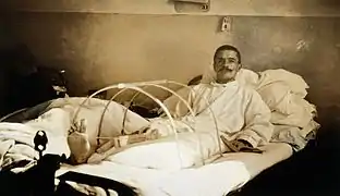 Soldat blessé à Verdun et amputé de la jambe à l'hôpital militaire de Ris-Orangis. 1916.