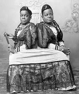 Millie et Christine McCoy (1851-1912), siamoises américaines.