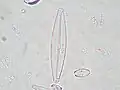 Navicula lanceolata.