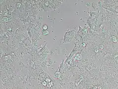 Description de l'image Neospora caninum (5256961091).jpg.