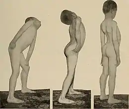 Description de l'image Nervous and mental diseases (1908) (14775871594).jpg.