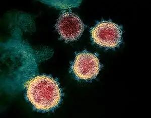 Description de l'image Novel Coronavirus SARS-CoV-2.jpg.