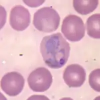 Plasmodium vivax (Plasmodiidae), l'agent d'une des formes de paludisme