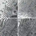 Cepedea longa en microscopie électronique