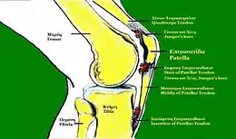 Description de l'image Patellar Tendonitis.jpg.