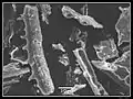 Phytolithes observés au MEB (3 sur 6)