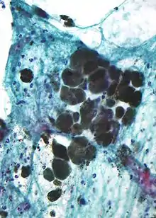 Vue microscopique montrant des tissus avec des paquets de cellules remplie de noir