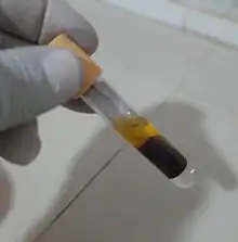  Image d'une main gate tenant un tube à analyse emplit de sang dans lequel les hématies ont coagulées au fond du tube et le sérum surnage en haut du tube