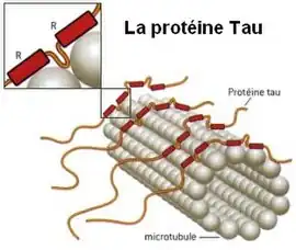 Image illustrative de l’article Protéine tau
