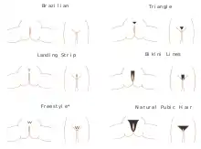 Graphique montrant différentes formes de poils pubiens