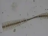 Ruban de Fragilaria crotonensis.