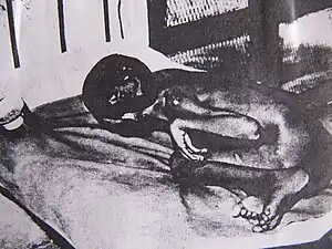 Ramu « enfant-loup » prétendument découvert dans la jungle en Inde : en fait, souffrant d'une sévère hémiplégie, il fut abandonné dans la gare ferroviaire de Lucknow, le 17 janvier 1954