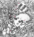 Particules enveloppées du virus de la fièvre de la vallée du Rift (Bunyaviridae) dans la lumière du réticulum endoplasmique.