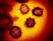 photo couleur en microscopie éléectronique montrant nettement 4 virus circulaires avec leurs glycoprotéines S bien visibles en surface