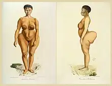 Saartjie Baartman, la « Vénus hottentote » (1789-1815).