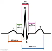 Schéma du rythme sinusal normal pour un cœur humain vu sur l'ECG (libellé en anglais)