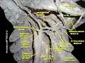 Dissection du cou montrant l'artère faciale. Vue de profil.