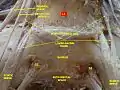 Dissection profonde de la région lombaire et du plexus sacral. Vue antérieure. (2)