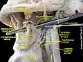 Dissection du cou montrant l'artère faciale. Vue de profil.