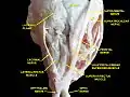 Vue supérieure d'une dissection de l'orbite gauche. Le nerf lacrymal est visible en innervant la glande lacrymale.