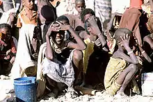 Enfants durant une famine en Somalie (1992).
