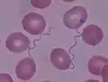 Deux spirochètes, dans un frottis sanguin, au milieu de globules rouges