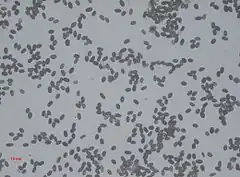 Description de l'image Stachybotrys Spores.jpg.