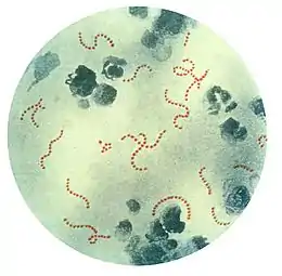 Description de l'image Streptococcus pyogenes 01.jpg.