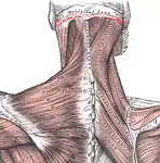 Vue postérieure de la ligne nucale supérieure (marquée en rouge) et des muscles qui s'y rattachent.