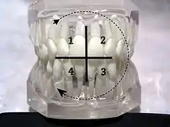 Notation ISO pour le repérage des quadrants de mâchoire adulte