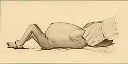 Description de l'image The diseases of infancy and childhood (1910) (14761683704).jpg.