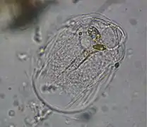 Thecamoeba striata (Amoebozoa)
