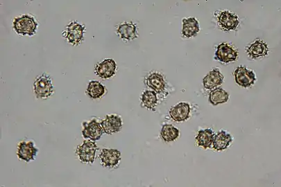 Spores d'une espèce de Tomentella indéterminée