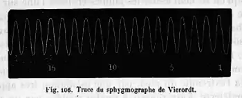 Fig. 106. Tracé isochrone du sphygmographe de Vierordt n'indiquant que le nombre de pulsations.