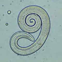 Description de l'image Trichinella larv1 DPDx.JPG.
