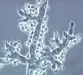 Trichoderma fertile (Ascomycetes, Hypocreales, Hypocreaceae)