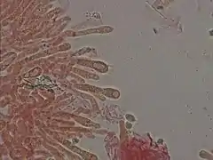  Photographie au microscope dont la préparation est teintée de rouge. Des tubes emmêlés se terminent par des boursouflures en forme de massue contenant parfois une forme sphérique ou ovoïde. L'une de ses boursouflures porte quatre dents