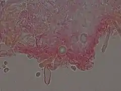  Photographie au microscope d'une masse informe colorée de rouge. Se dégage de cette masse, une sorte de tube gonflé